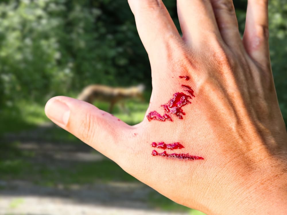 dog-bite-wound dog bite wound